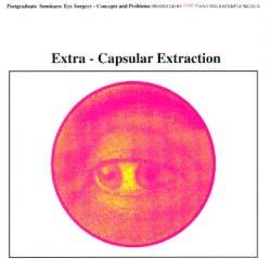 Earth (USA) : Extra-Capsular Extraction